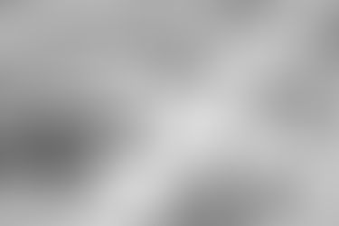 What happens in retinal barrage laser before Lasik eye surgery?